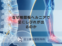なぜ椎間板ヘルニアで足にしびれが出るのか