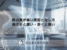 膝の裏が痛い原因と治し方｜曲げると痛い・歩くと痛い