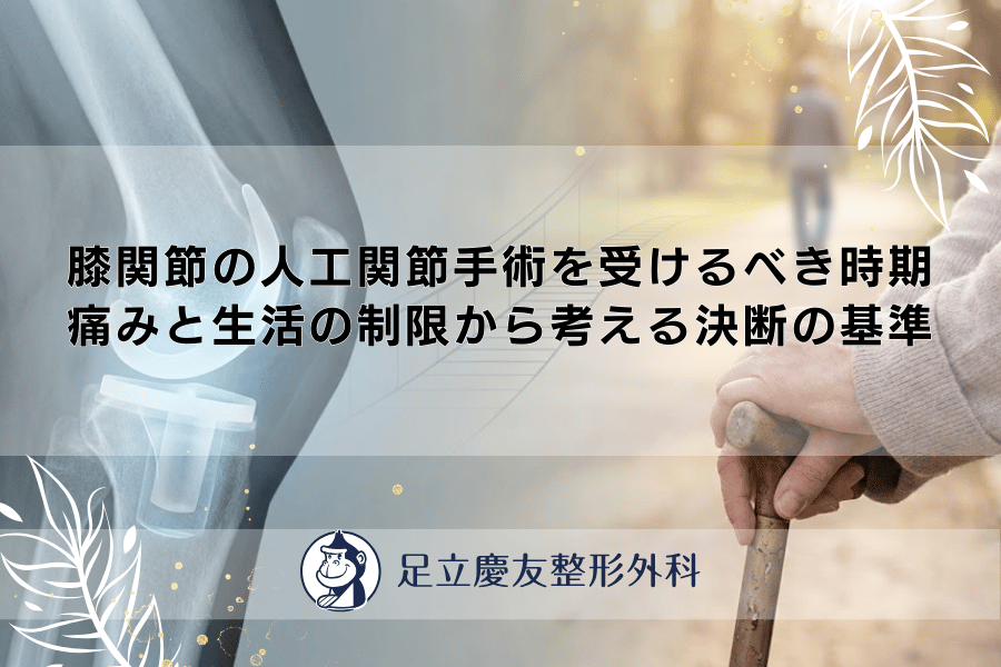 膝関節の人工関節手術を受けるべき時期｜痛みと生活の制限から考える