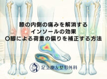 膝の内側の痛みを解消するインソールの効果｜O脚による荷重の偏りを補正する方法