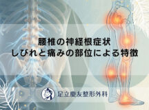 腰椎の神経根症状｜しびれと痛みの部位による特徴