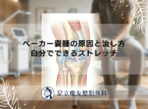 ベーカー嚢腫の原因と治し方｜自分でできるストレッチ