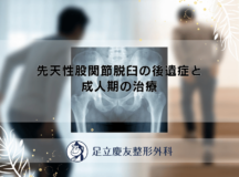 先天性股関節脱臼の後遺症と成人期の治療