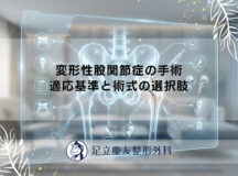 変形性股関節症の手術｜適応基準と術式の選択肢