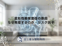 変形性股関節症の原因｜なぜ発症するのか・リスク因子