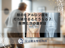 膝のヒアルロン酸を打ち続けるとどうなる？限界と次の選択肢