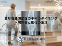 変形性膝関節症の手術のタイミング｜入院期間と術後の生活