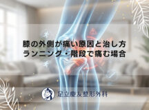 膝の外側が痛い原因と治し方｜ランニング・階段で痛む場合