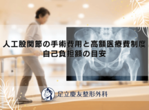 人工股関節の手術費用と高額医療費制度｜自己負担額の目安