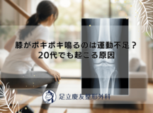 膝がポキポキ鳴るのは運動不足？20代でも起こる原因