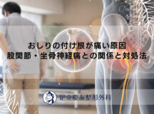 おしりの付け根が痛い原因｜股関節・坐骨神経痛との関係と対処法