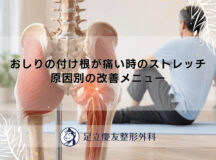 おしりの付け根が痛い時のストレッチ｜原因別の改善メニュー