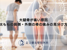 大腿骨が痛い原因｜太ももの前側・外側の骨の痛みの見分け方