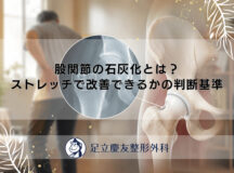 股関節の石灰化とは？ストレッチで改善できるかの判断基準