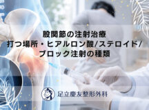 股関節の注射治療｜打つ場所・ヒアルロン酸/ステロイド/ブロック注射の種類
