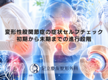 変形性股関節症の症状セルフチェック｜初期から末期までの進行段階