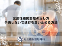 変形性股関節症の治し方｜手術しないで進行を食い止める方法