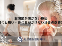 股関節が開かない原因｜開くと痛い・あぐらがかけない場合の改善法