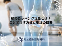 膝のロッキング現象とは？自分で治す方法と受診の目安