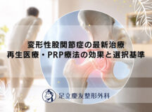 変形性股関節症の最新治療｜再生医療・PRP療法の効果と選択基準