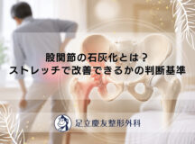 変形性股関節症のやってはいけないこと｜禁忌動作と生活注意点