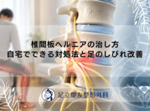 椎間板ヘルニアの治し方｜自宅でできる対処法と足のしびれ改善