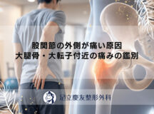股関節の外側が痛い原因｜大腿骨・大転子付近の痛みの鑑別