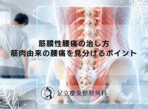 筋膜性腰痛の治し方｜筋肉由来の腰痛を見分けるポイント
