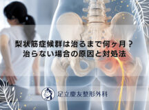 梨状筋症候群は治るまで何ヶ月？治らない場合の原因と対処法