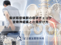 梨状筋症候群の症状チェック｜坐骨神経痛との見分け方