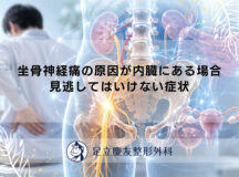 坐骨神経痛の原因が内臓にある場合｜見逃してはいけない症状