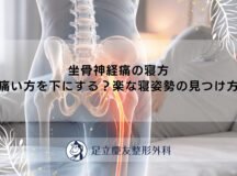 坐骨神経痛の寝方｜痛い方を下にする？楽な寝姿勢の見つけ方