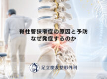 脊柱管狭窄症の原因と予防｜なぜ発症するのか