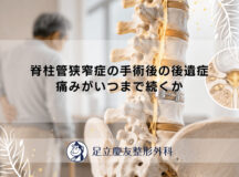 脊柱管狭窄症の手術後の後遺症|痛みがいつまで続くか