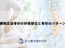 腰椎圧迫骨折の好発部位と骨折のパターン
