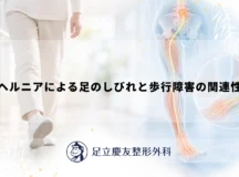 ヘルニアによる足のしびれと歩行障害の関連性