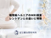 椎間板ヘルニアのMRI検査｜レントゲンとの違いと特徴