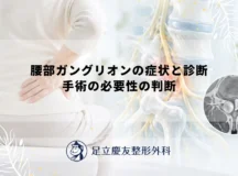 腰部ガングリオンの症状と診断｜手術の必要性の判断